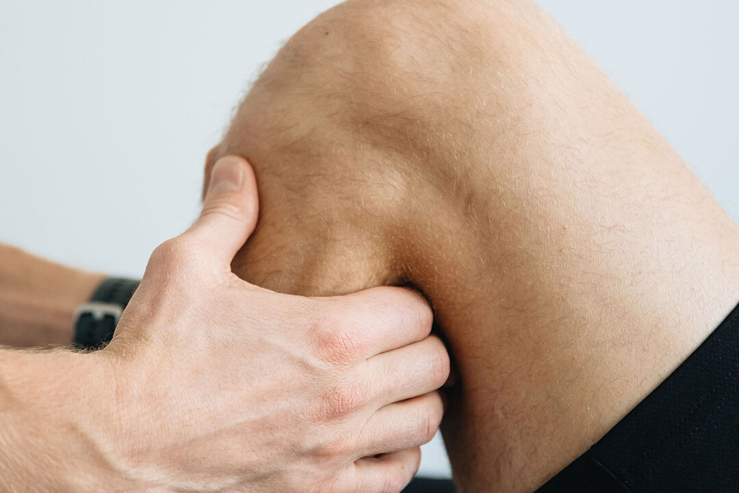 Kje vas boli – Poškodba medialnega patelofemoralnega ligamenta (MPFL)